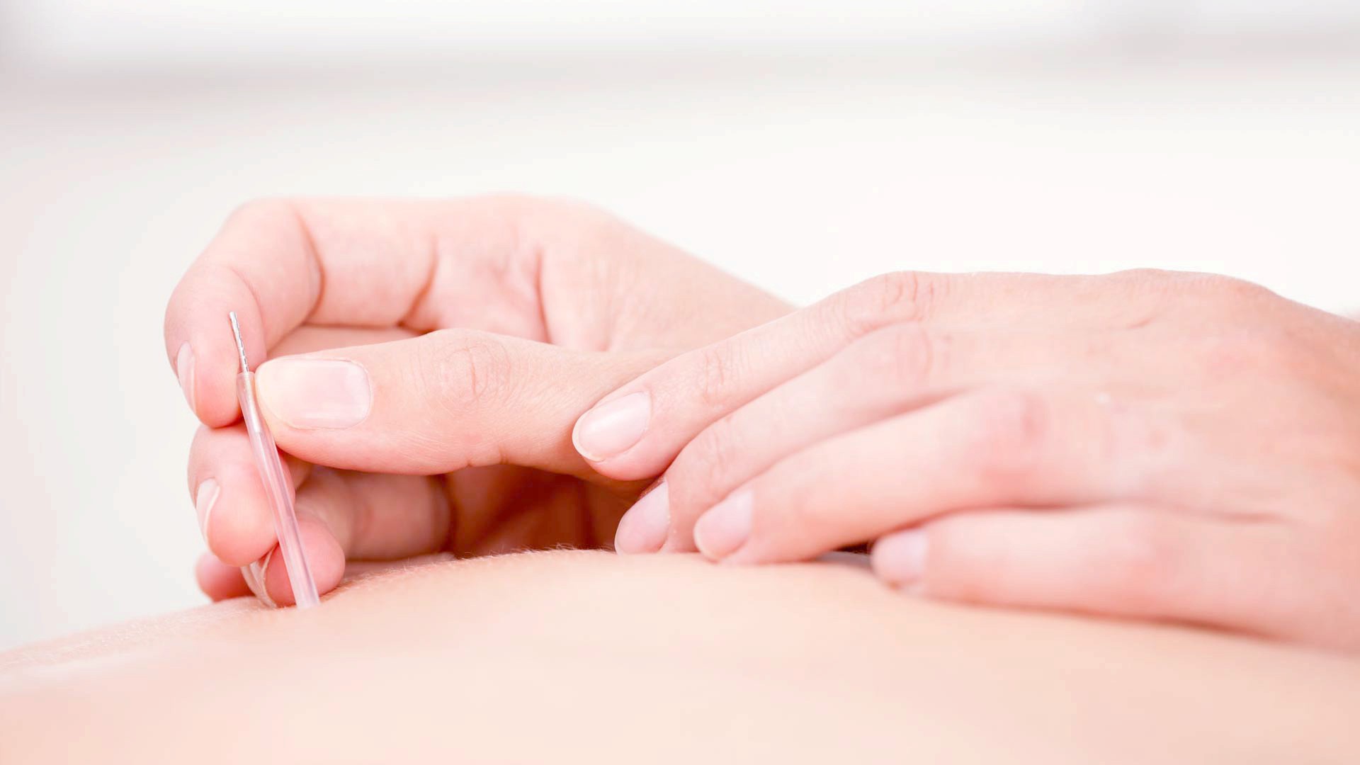 Dry needling Ytje Geertsema
